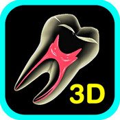 Tooth 3D